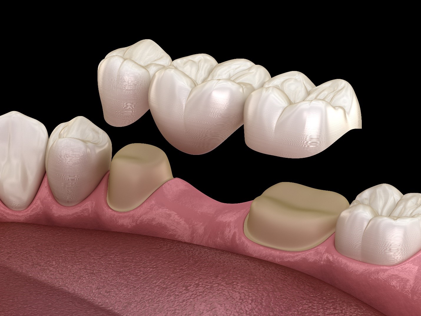 Ura Dentare